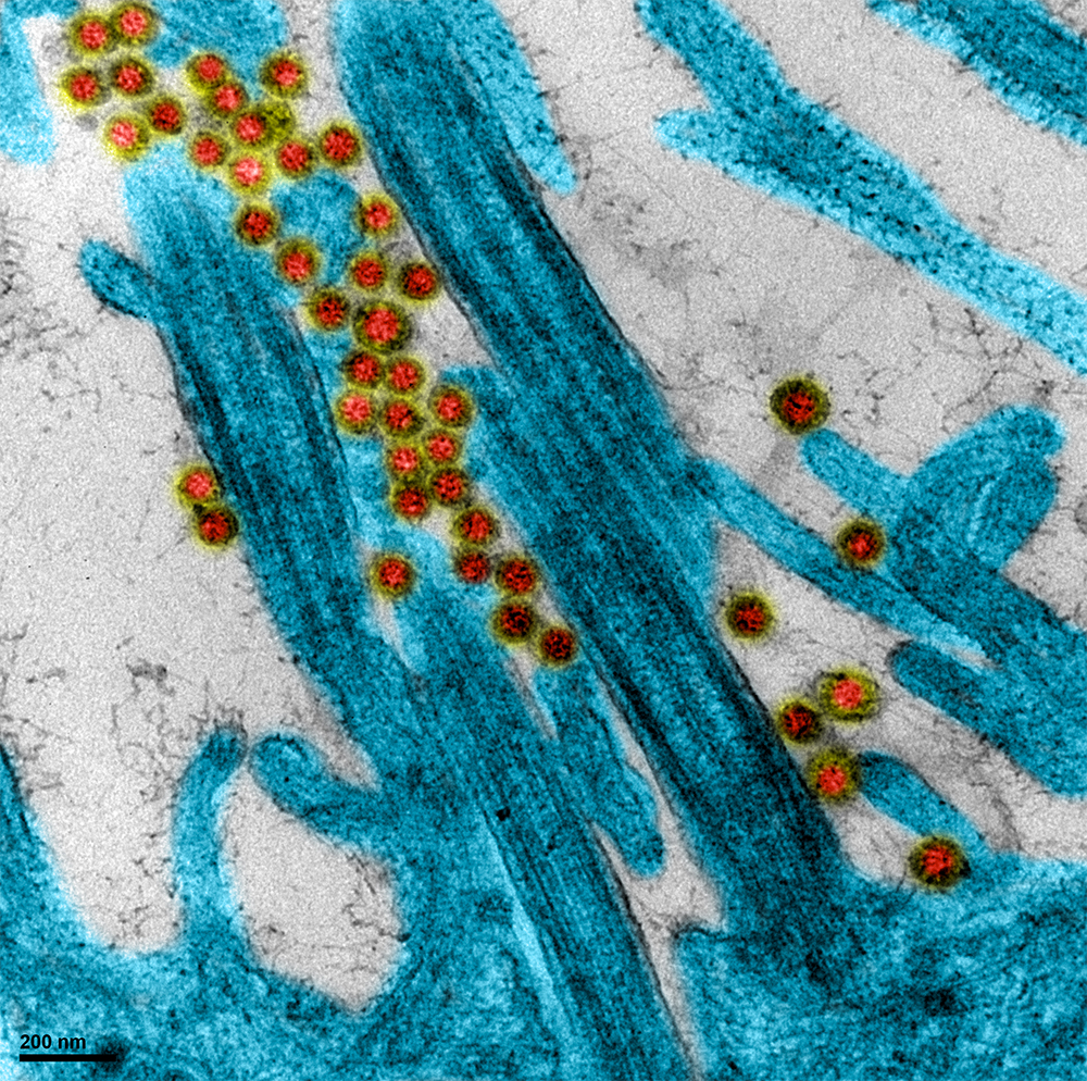 Une des toutes premi&egrave;res images du virus SARS-CoV-2 isol&eacute; de patients