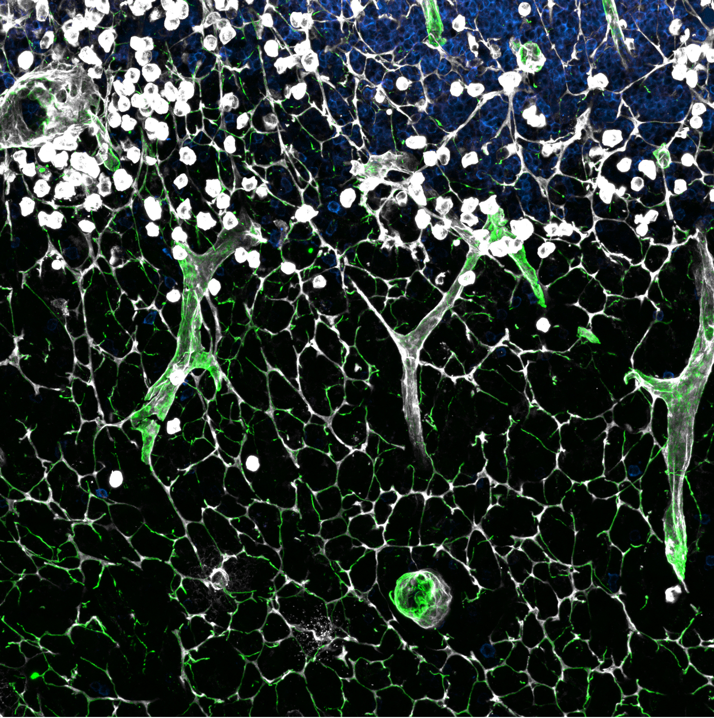 Image sous microscope &agrave; fluorescence