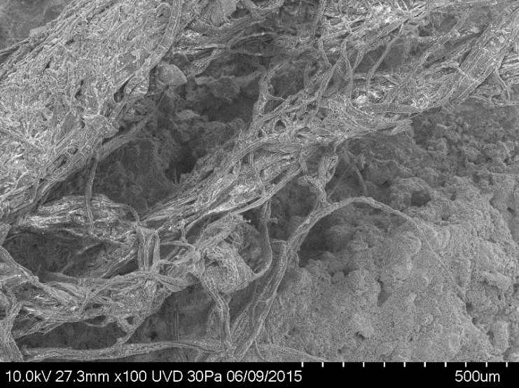 fibres du fragment de corde vues au microscope &eacute;lectronique