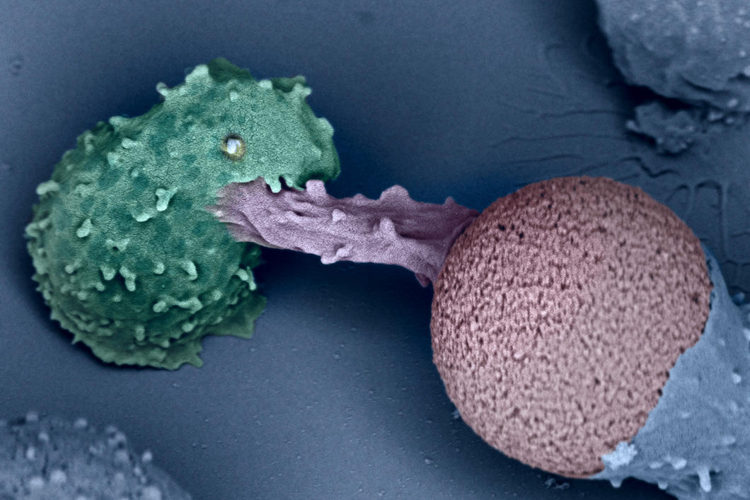 Virginie Bazin IPBS / Universit&eacute; Pierre et Marie Curie, Claire Hivroz, Julien Husson / CNRS / Ecole polytechnique / Inserm / Institut Curie, 2016