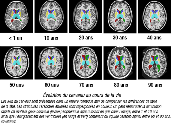 &eacute;volution du cerveau au cours de la vie 