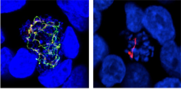 Parasite de la malaria &agrave; l'int&eacute;rieur de cellules de foie humaines. 