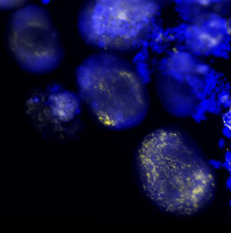 Vue microscopique d'ovocytes (en bleu) de la tique molle Ornithodoros moubata. La pr&eacute;sence de Francisella symbiotiques (en jaune) est ici mise en &eacute;vidence dans les ovocytes par une hybridation in situ en fluorescence.