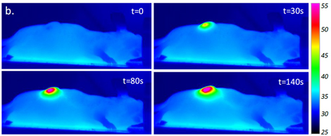 Images infrarouges d'une souris anesth&eacute;si&eacute;e lorsque sa tumeur, inject&eacute;e de nanotubes, est expos&eacute;e &agrave; un laser. L'&eacute;chelle de droite repr&eacute;sente la temp&eacute;rature en surface.