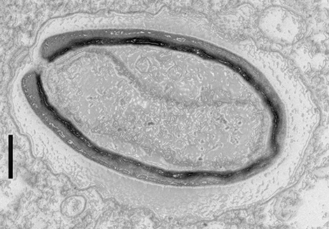 Pandoravirus quercus, trouv&eacute; &agrave; Marseille. 