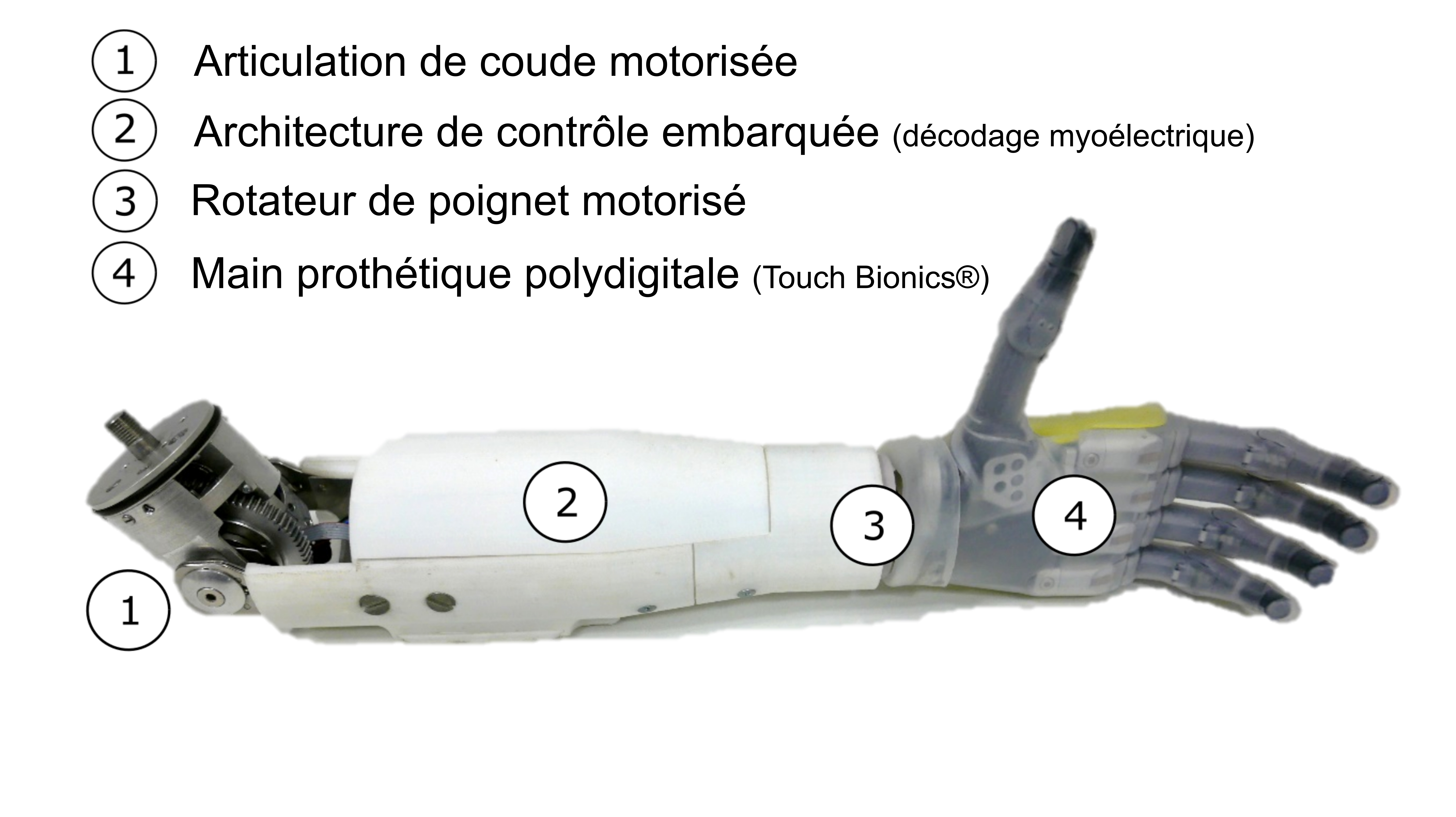 Descriptif proth&egrave;se