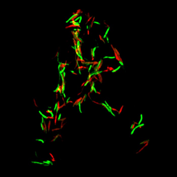 bact&eacute;ries color&eacute;es par des marqueurs fluorescents, vues au microscope