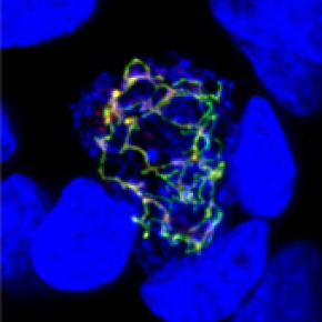 Malaria and toxoplasmosis have an Achilles heel from plants